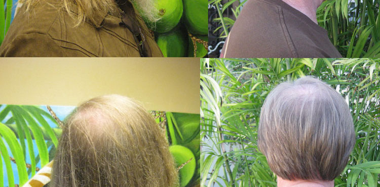 Man Before and After